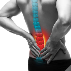 A Comprehensive Guide to Lumbar Disc Herniation and its Connection to Back Pain